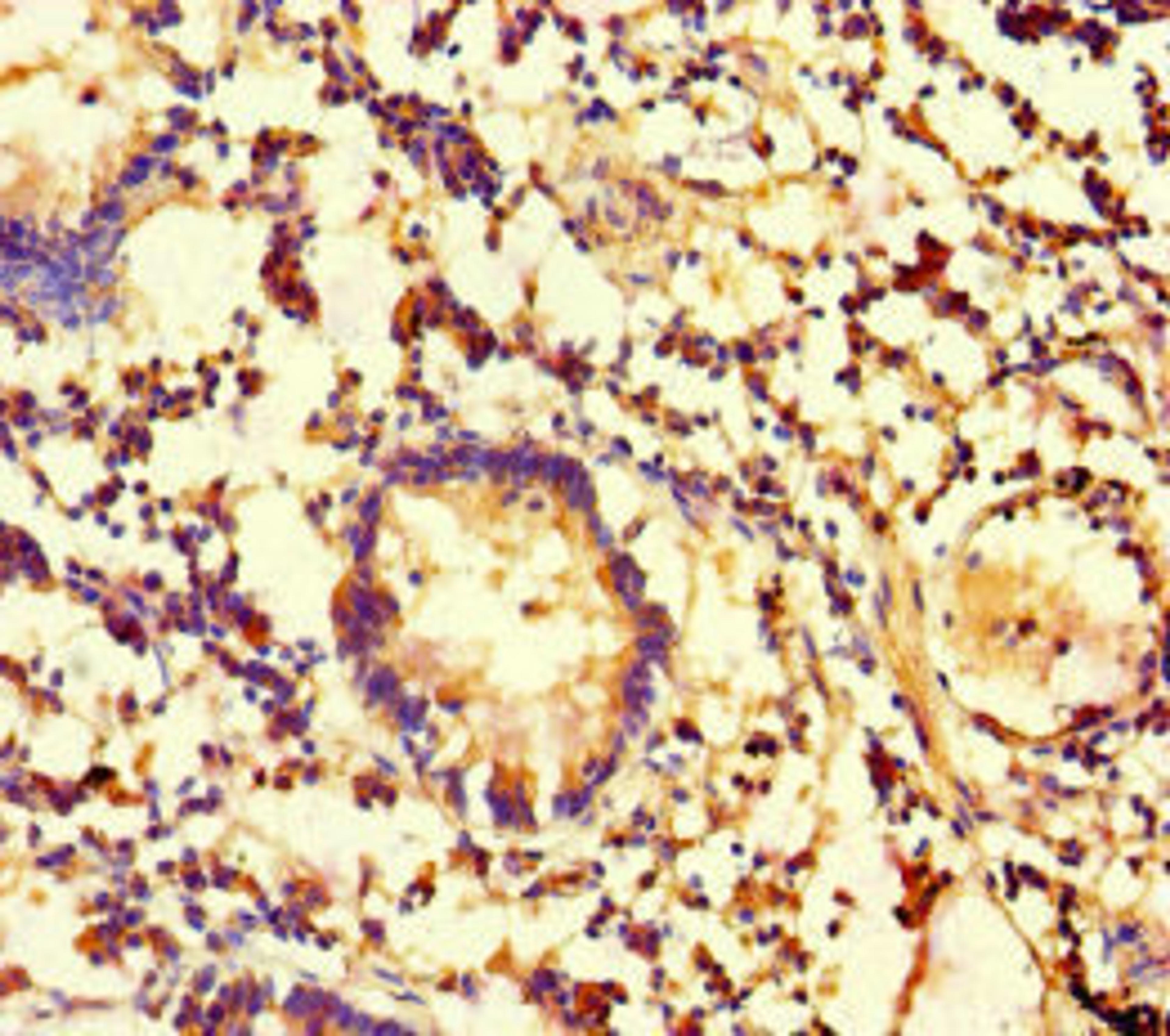 Immunohistochemistry of paraffin-embedded human appendix tissue using CSB-PA005260LA01HU at dilution of 1:100
