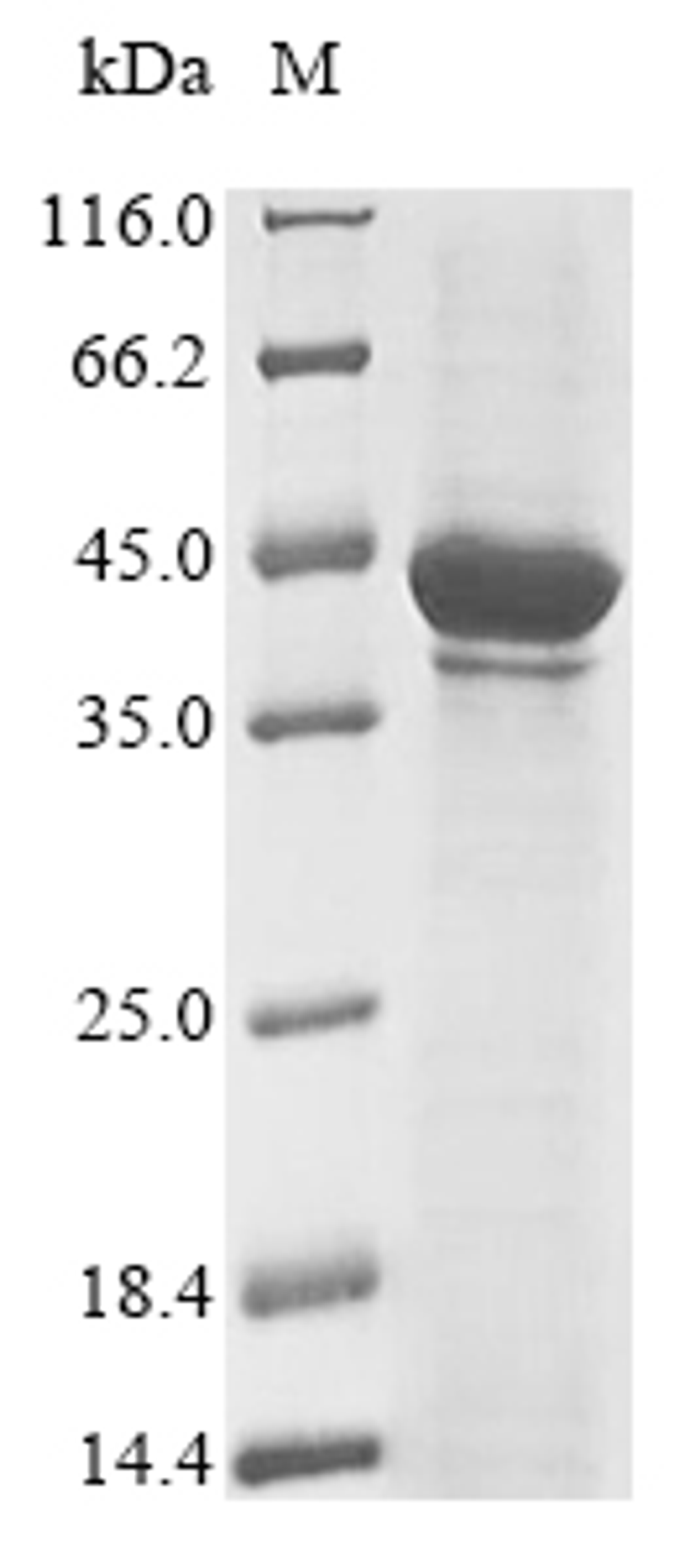 (Tris-Glycine gel) Discontinuous SDS-PAGE (reduced) with 5% enrichment gel and 15% separation gel.