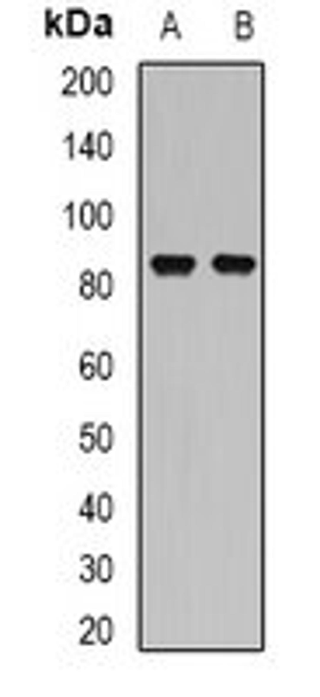 Western blot analysis of SW620 (Lane1), Hela (Lane2) whole cell lysates using SSRP1 antibody