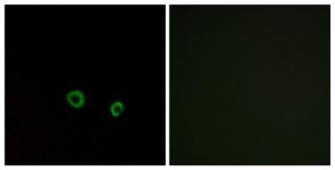 Immunocytochemistry/Immunofluorescence: TAS2R10 Antibody [NBP1-71302] - Analysis of MCF7 cells, using . The picture on the right is treated with the synthesized peptide.