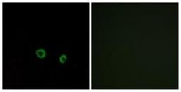 Immunocytochemistry/Immunofluorescence: TAS2R10 Antibody [NBP1-71302] - Analysis of MCF7 cells, using . The picture on the right is treated with the synthesized peptide.