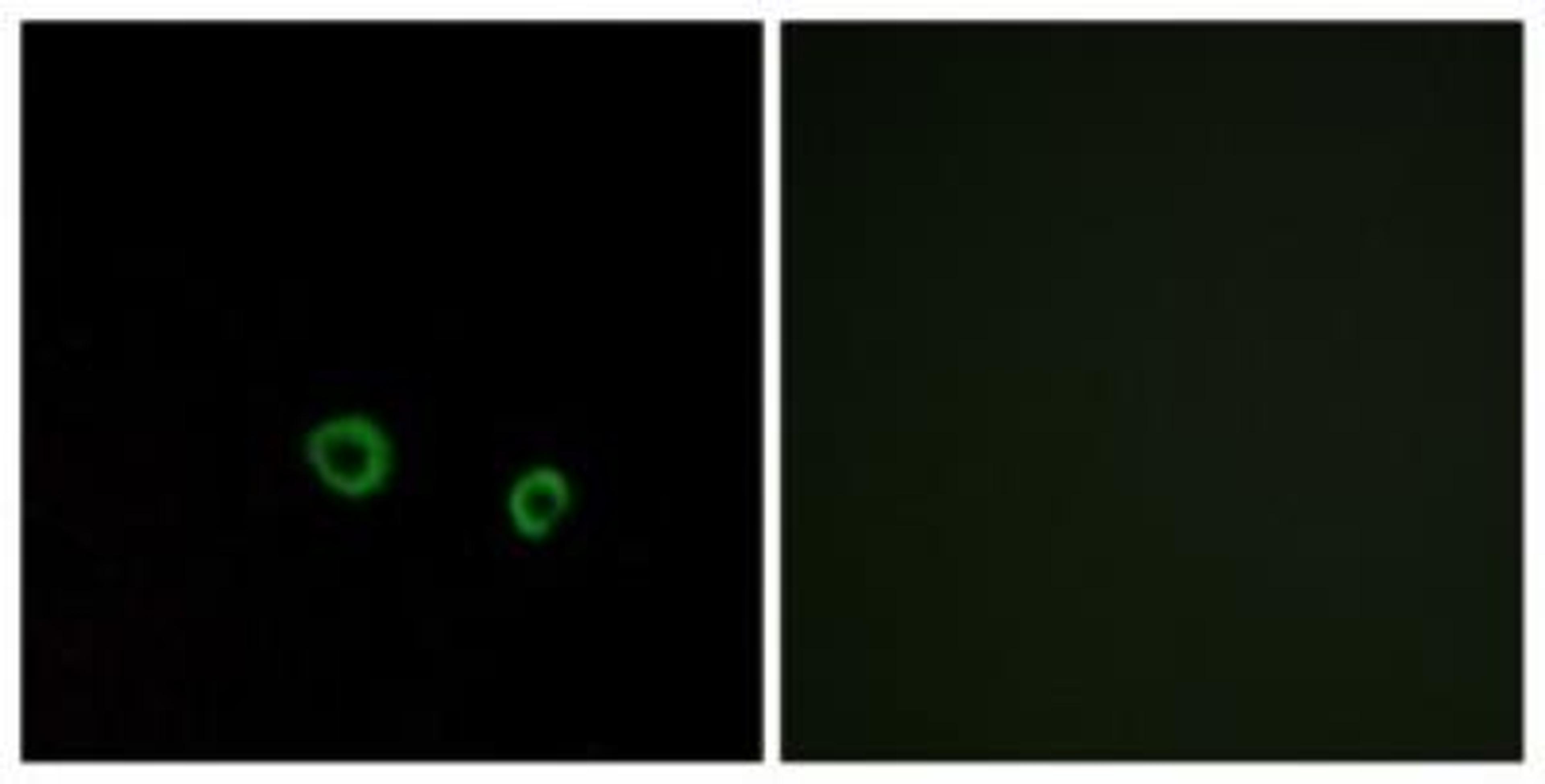 Immunocytochemistry/Immunofluorescence: TAS2R10 Antibody [NBP1-71302] - Analysis of MCF7 cells, using . The picture on the right is treated with the synthesized peptide.