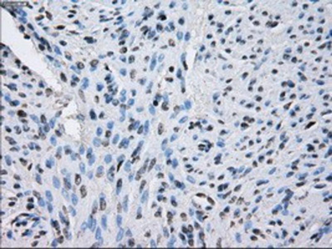 Immunohistochemistry-Paraffin: Sorbitol Dehydrogenase Antibody (9E7) [NBP2-02126] - Staining of paraffin-embedded endometrium tissue using anti-Sorbitol Dehydrogenase mouse monoclonal antibody.