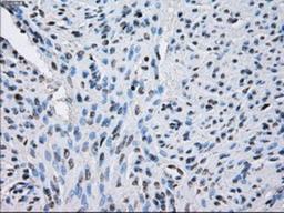 Immunohistochemistry-Paraffin: Sorbitol Dehydrogenase Antibody (9E7) [NBP2-02126] - Staining of paraffin-embedded endometrium tissue using anti-Sorbitol Dehydrogenase mouse monoclonal antibody.