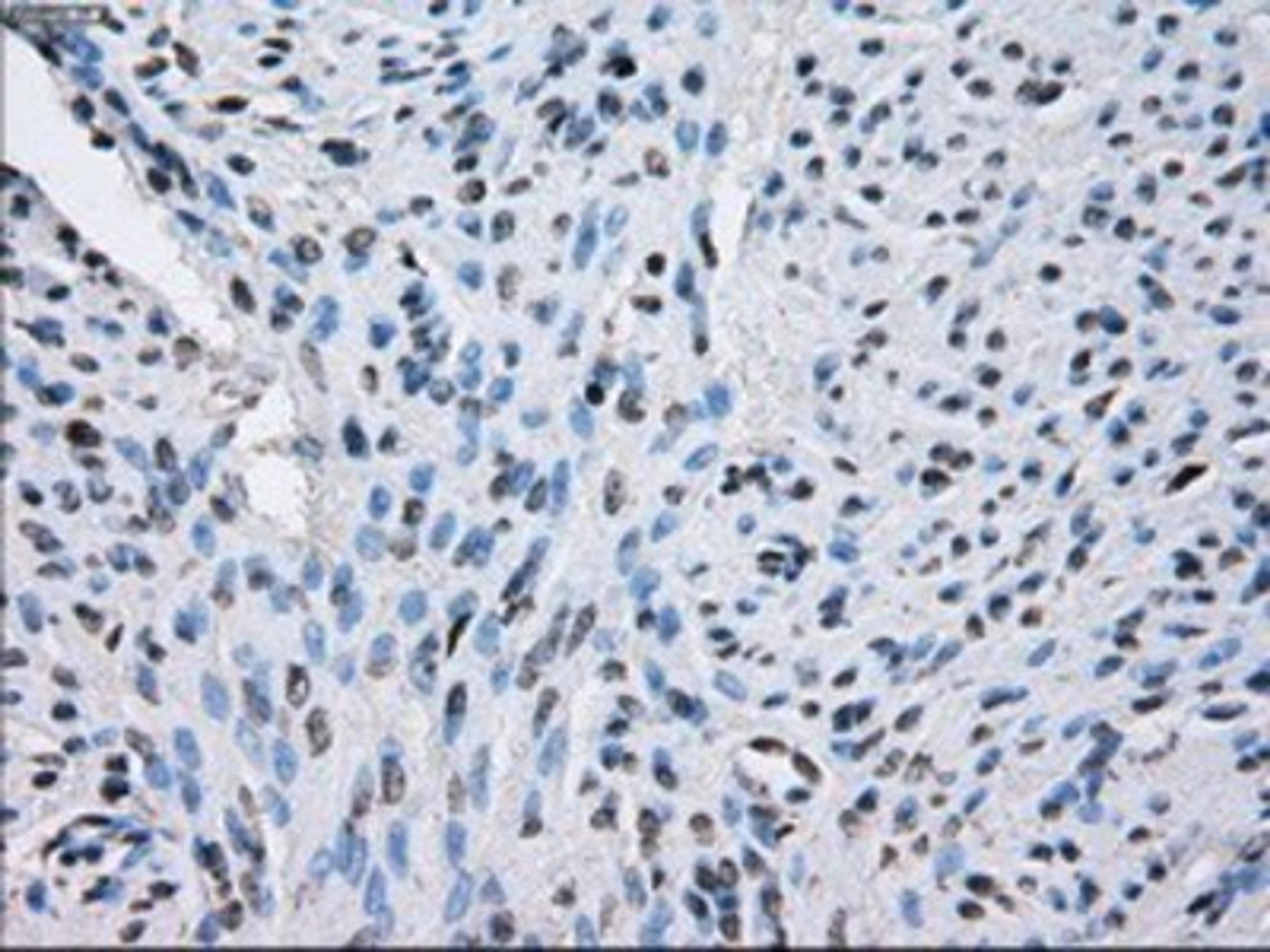 Immunohistochemistry-Paraffin: Sorbitol Dehydrogenase Antibody (9E7) [NBP2-02126] - Staining of paraffin-embedded endometrium tissue using anti-Sorbitol Dehydrogenase mouse monoclonal antibody.