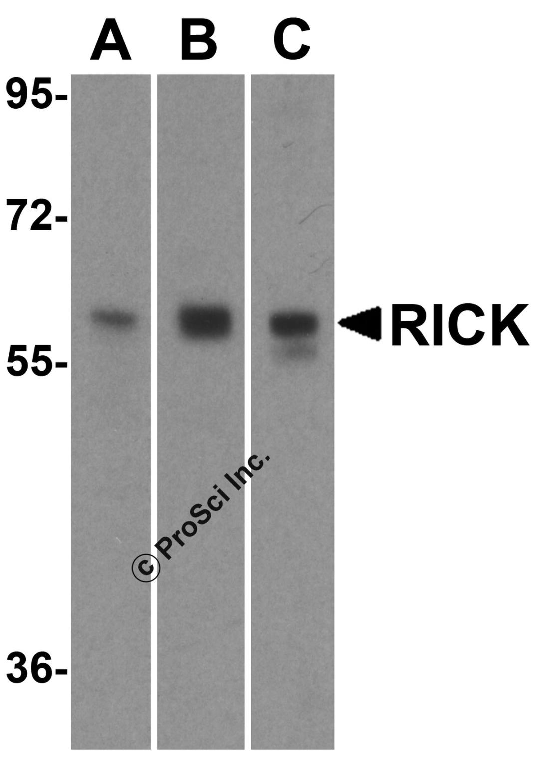 Western blot analysis of RICK in (A) HeLa, (B) Ramos and (C) EL4 cell lysate with RICK antibody at 1 μg/mL.