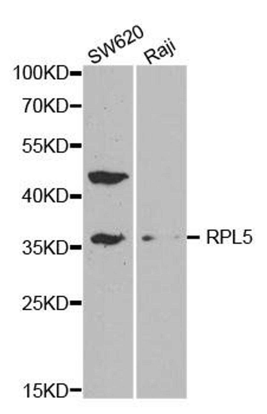 Western blot analysis of extracts of various cell lines using RPL5 antibody