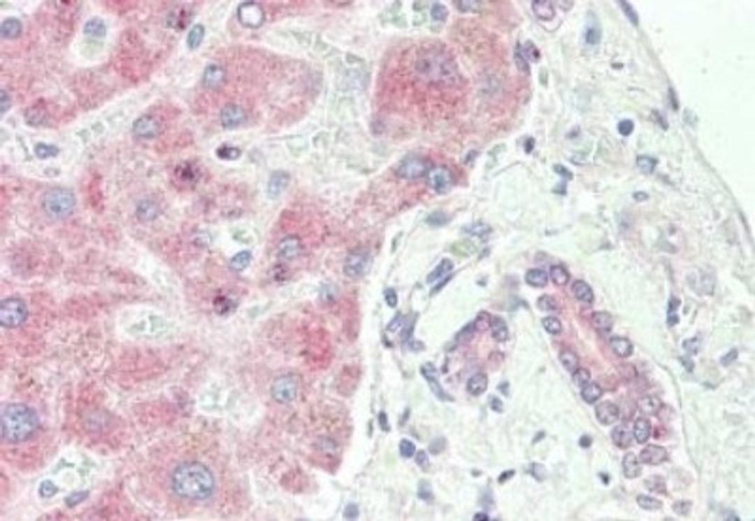 Immunohistochemistry: SPRY2 Antibody [NBP2-13158] - Tissue: liver. Fixation: formalin fixed paraffin embedded. Primary antibody: Anti-sprouty 2 at 10 ug/mL for 1 h at RT. Secondary antibody: Peroxidase rabbit secondary antibody at 1:10,000 for 45 min at RT. Staining: Sprouty-2 as precipitated red signal with hematoxylin purple nuclear counterstain.