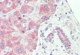 Immunohistochemistry: SPRY2 Antibody [NBP2-13158] - Tissue: liver. Fixation: formalin fixed paraffin embedded. Primary antibody: Anti-sprouty 2 at 10 ug/mL for 1 h at RT. Secondary antibody: Peroxidase rabbit secondary antibody at 1:10,000 for 45 min at RT. Staining: Sprouty-2 as precipitated red signal with hematoxylin purple nuclear counterstain.