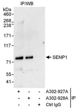 Detection of human SENP1 by western blot of immunoprecipitates.