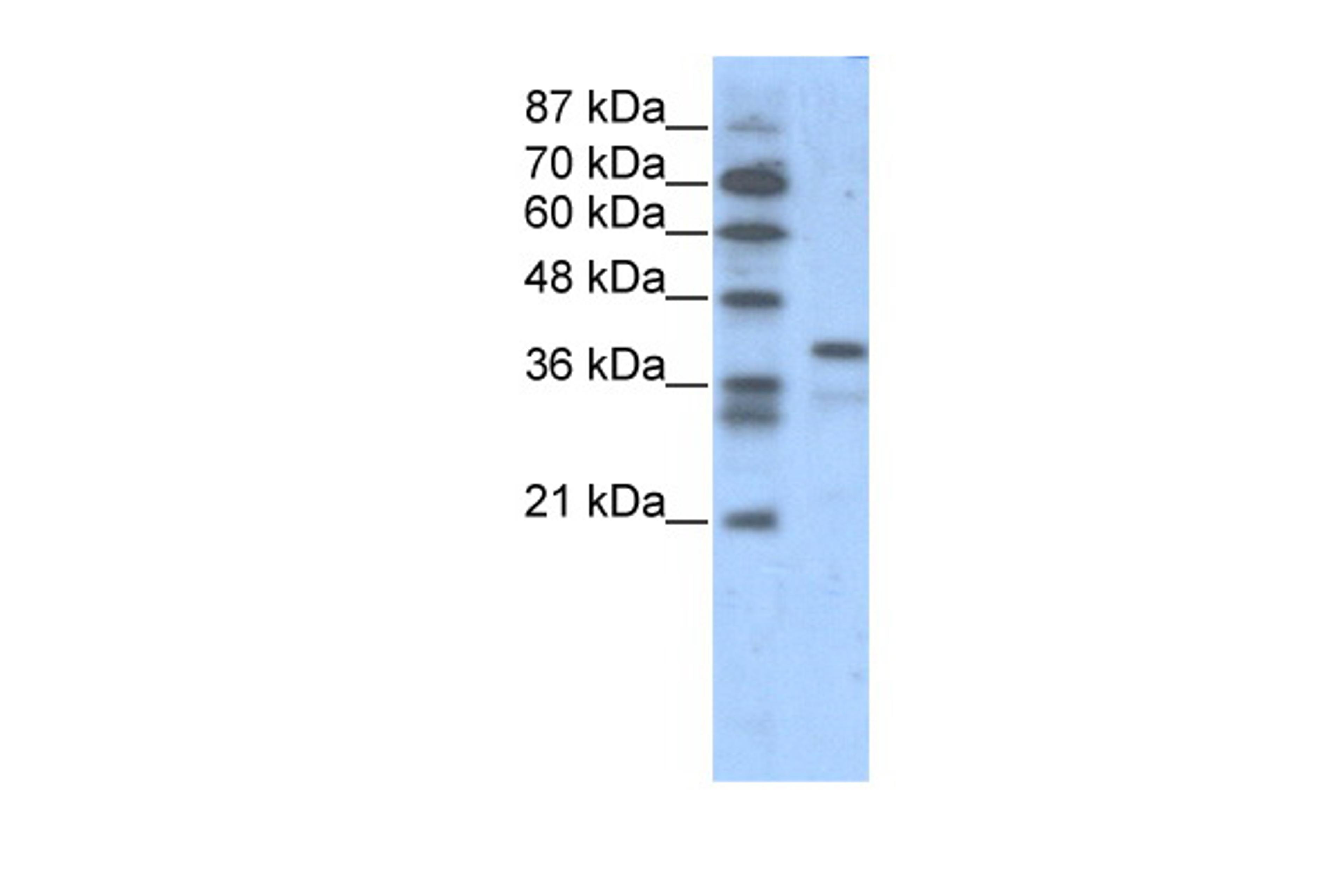 Antibody used in WB on Human Jurkat 1.25 ug/ml.