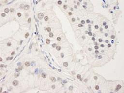 Detection of human UACA by immunohistochemistry.