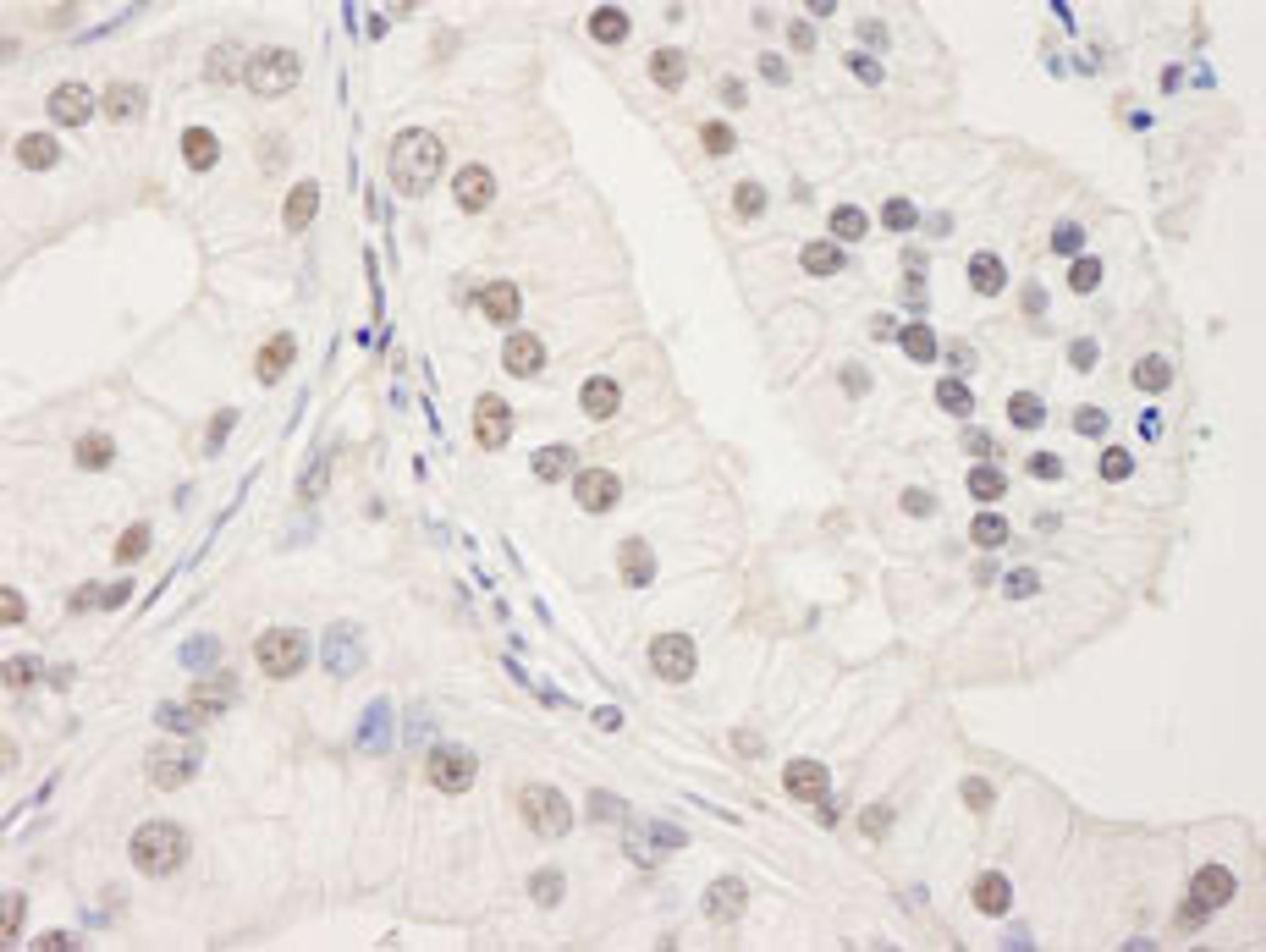 Detection of human UACA by immunohistochemistry.