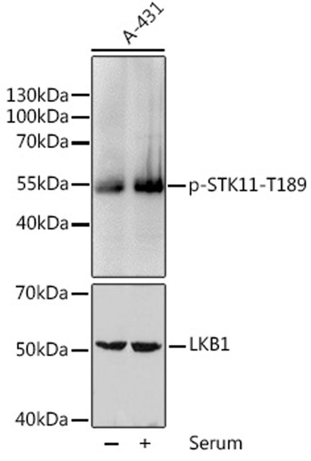 Western blot - Phospho-STK11-T189 pAb (AP0603)