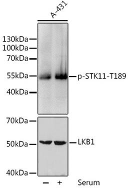 Western blot - Phospho-STK11-T189 pAb (AP0603)