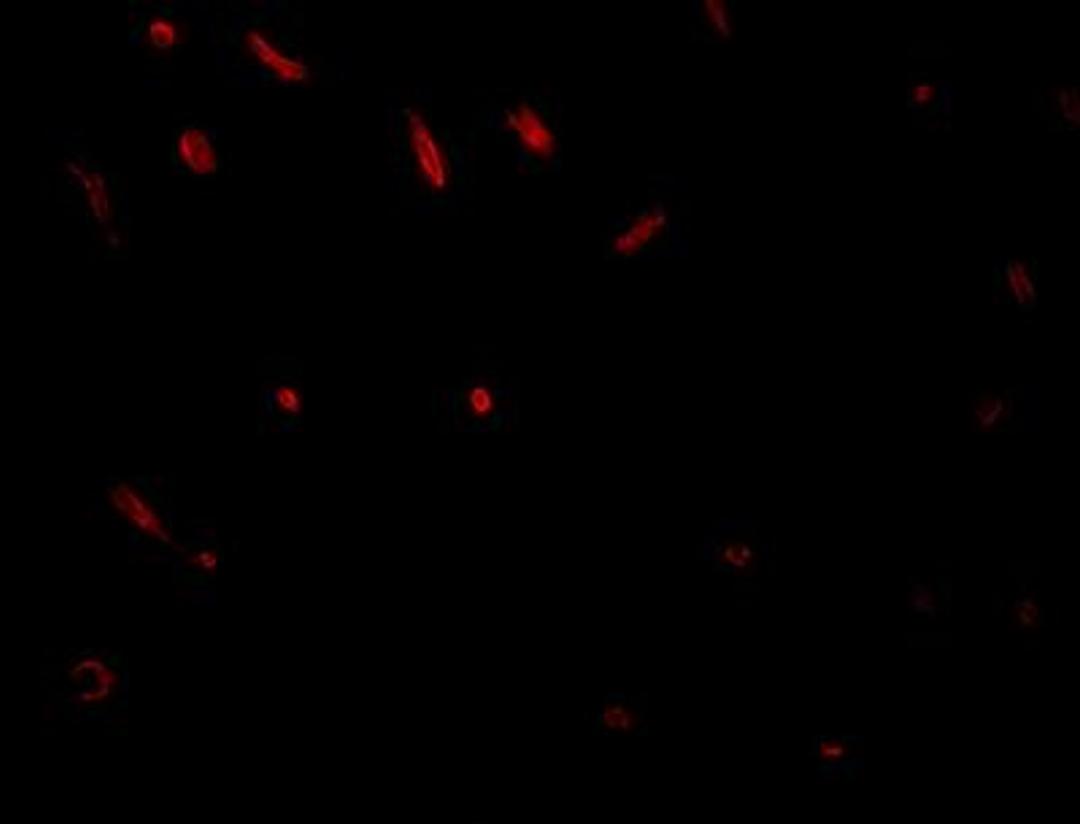 Immunocytochemistry/Immunofluorescence: TWA1 Antibody [NBP1-77366] - Immunofluorescence of TWA1 in rat brain tissue with TWA1 antibody at 20 ug/mL.