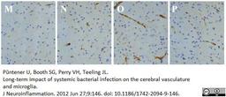 Rat anti Mouse CD106 antibody used to evaluate VCAM-1 expression in the murine thalamus