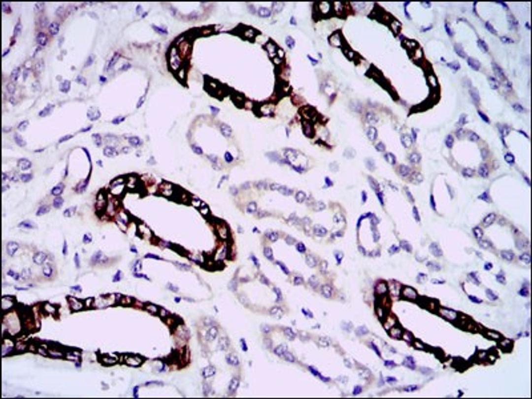 Immunohistochemistry: GAB1 Antibody (1A7) [NBP2-37742] - Immunohistochemical analysis of paraffin-embedded kidney tissues using GAB1 mouse mAb with DAB staining.