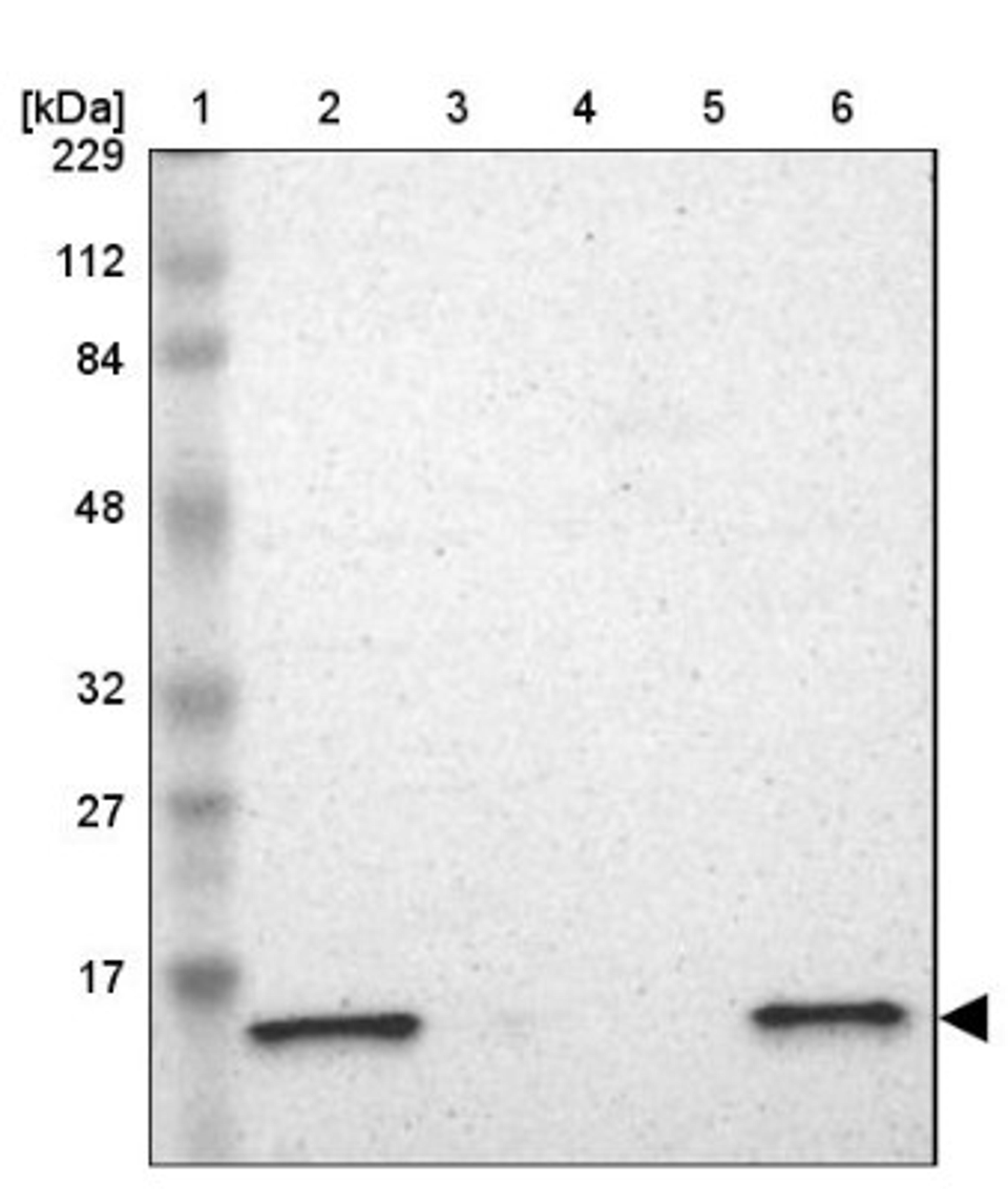 Western Blot: ATP5D Antibody [NBP1-86162] - Lane 1: Marker [kDa] 229, 112, 84, 48, 32, 27, 17<br/>Lane 2: Human cell line RT-4<br/>Lane 3: Human cell line U-251MG sp<br/>Lane 4: Human plasma (IgG/HSA depleted)<br/>Lane 5: Human liver tissue<br/>Lane 6: Human tonsil tissue