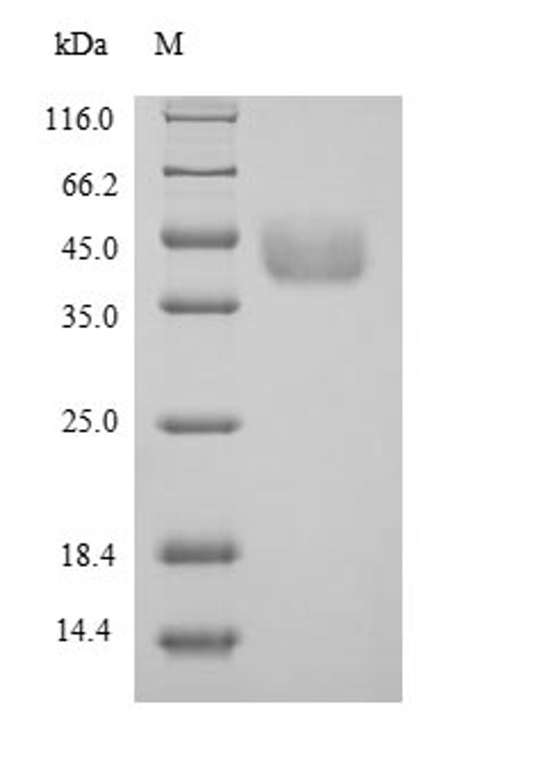 (Tris-Glycine gel) Discontinuous SDS-PAGE (reduced) with 5% enrichment gel and 15% separation gel.