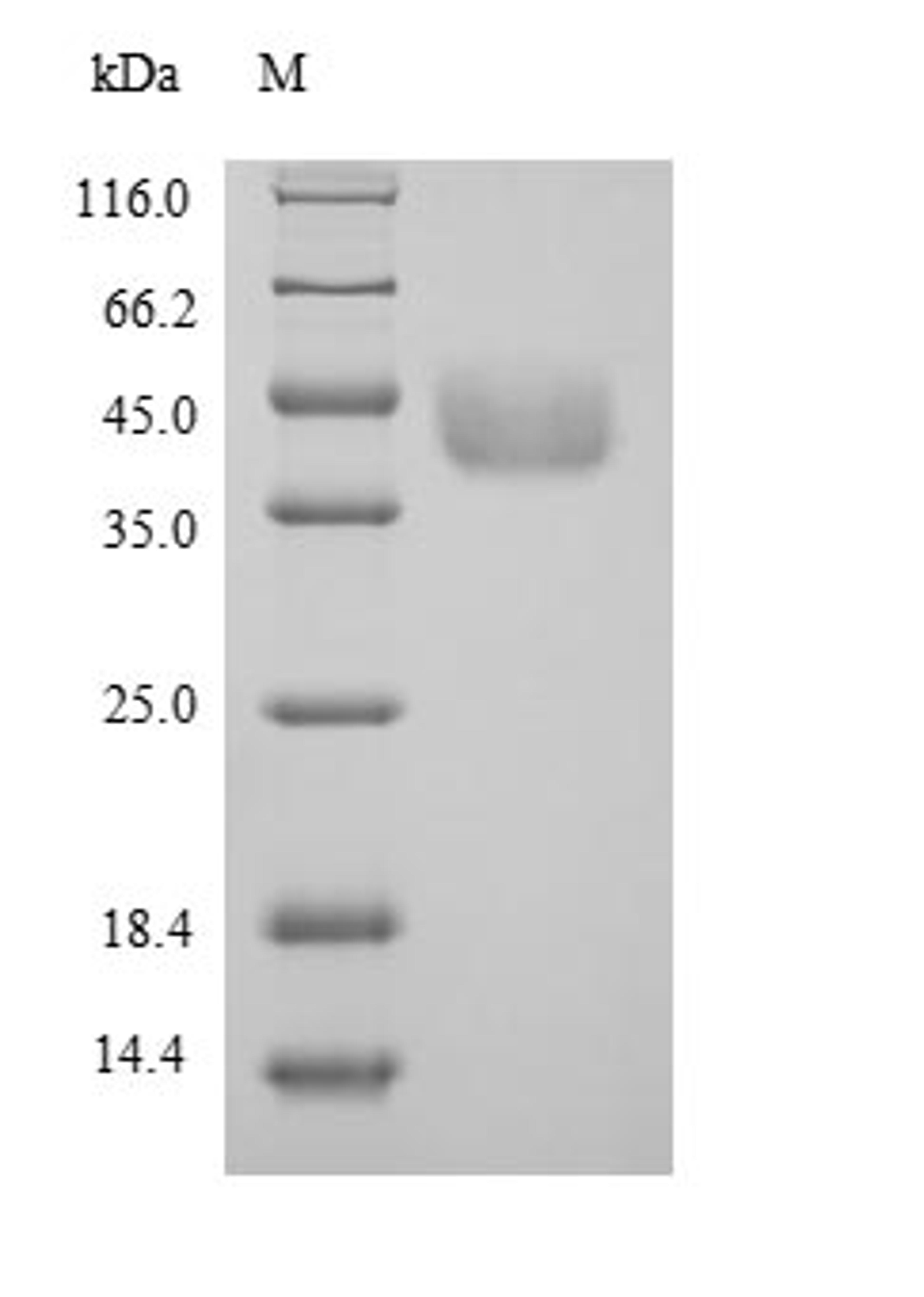 (Tris-Glycine gel) Discontinuous SDS-PAGE (reduced) with 5% enrichment gel and 15% separation gel.