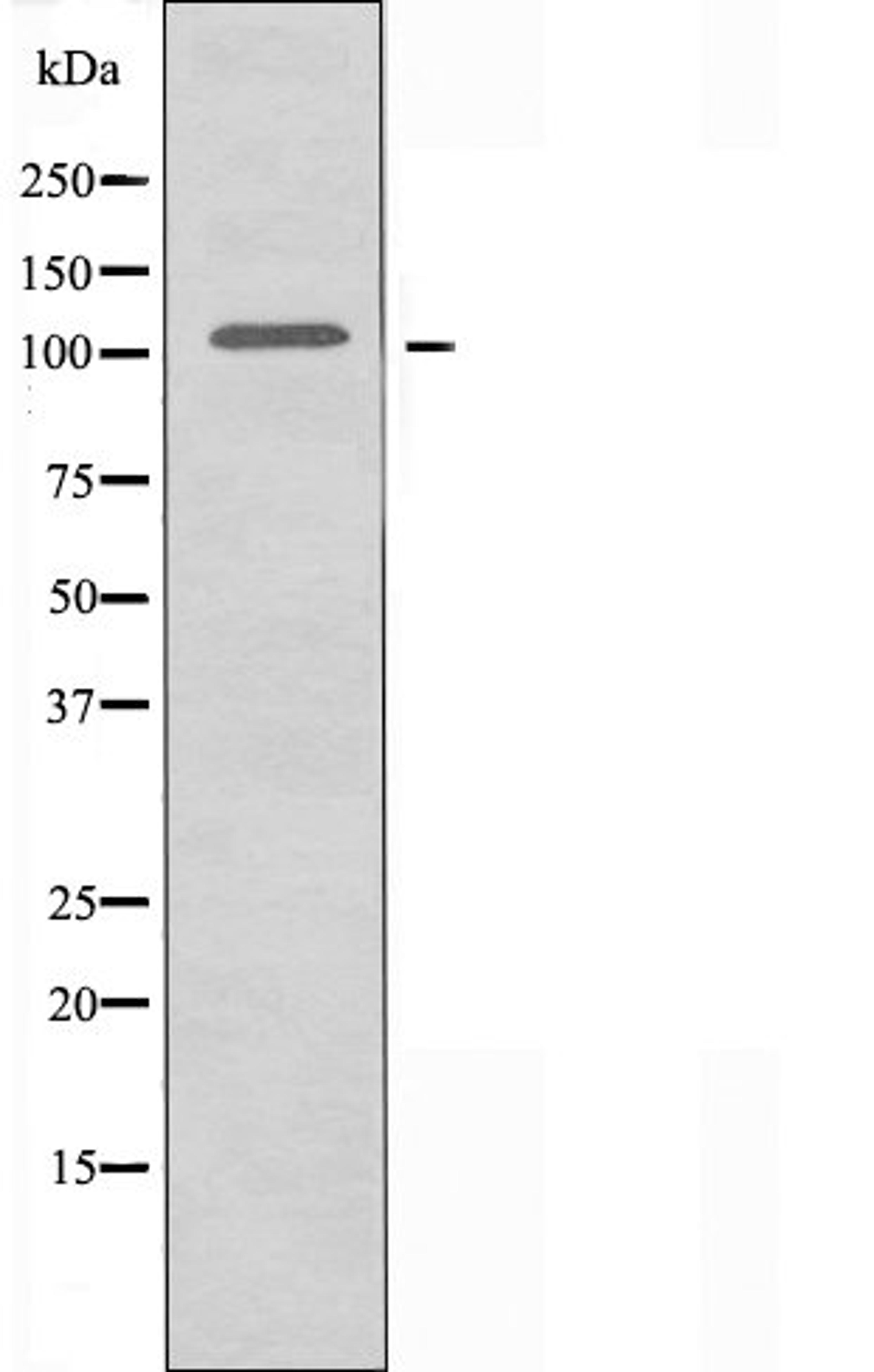 Western blot analysis of HepG2 cells using ZZZ3 antibody