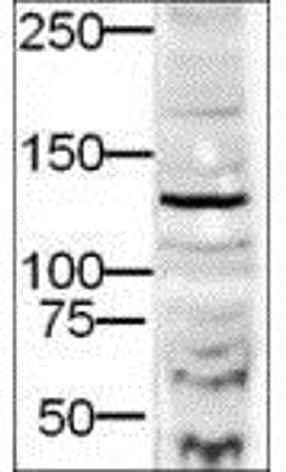 Western blot analysis of HEK293 cells using DIA-2 antibody