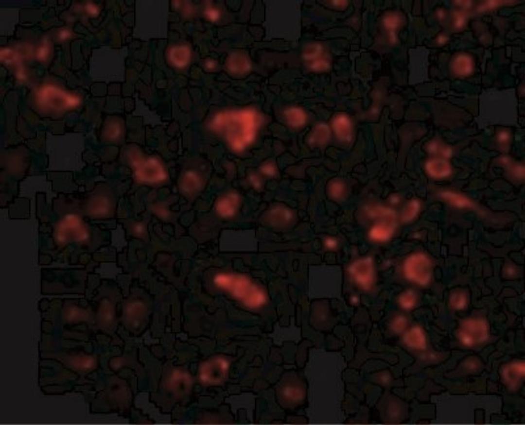 Immunocytochemistry/Immunofluorescence: ARMET Antibody [NBP1-76836] - Immunofluorescence of MANF in Human Brain cells with MANF antibody at 20 ug/mL.