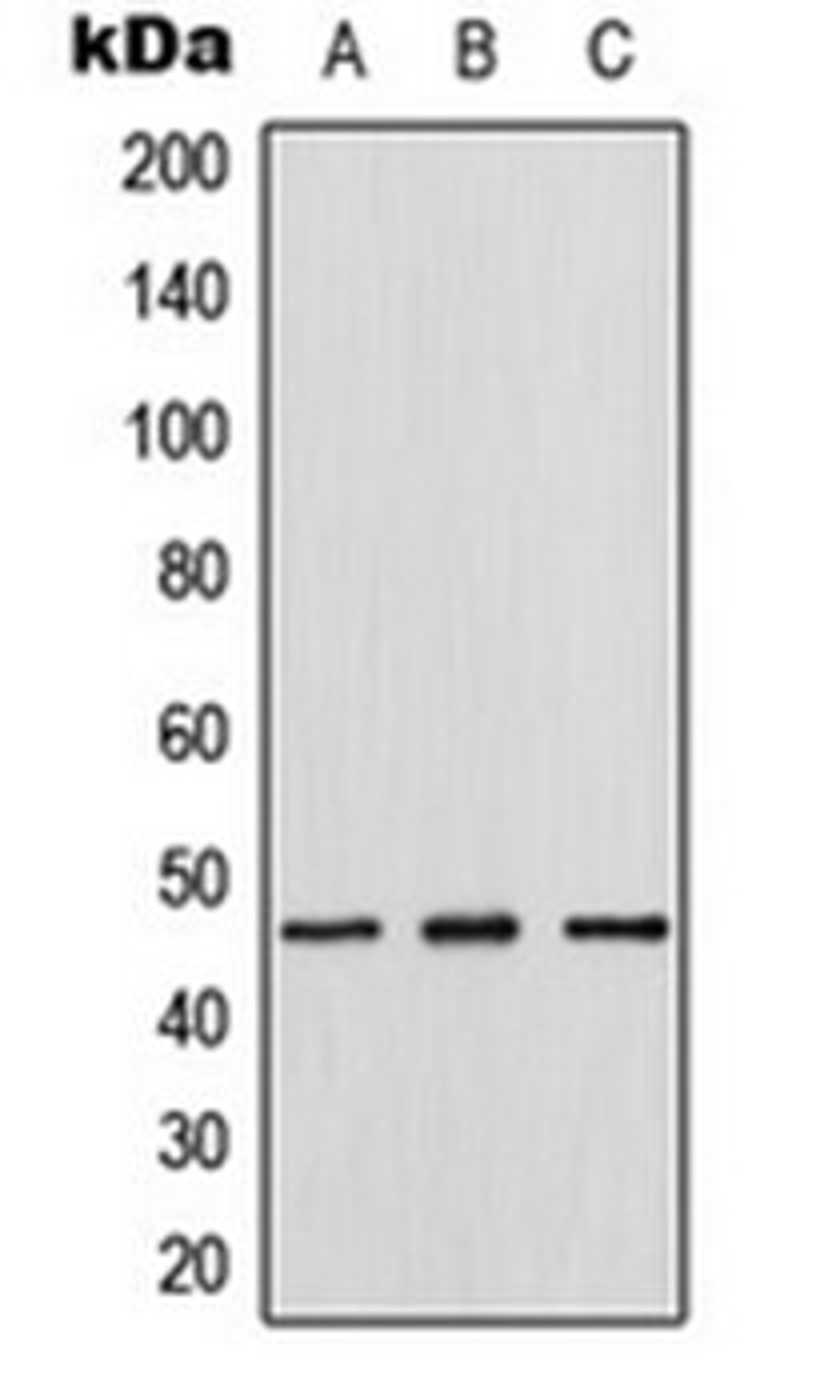 Western blot analysis of HeLa (Lane 1), mouse lung (Lane 2), rat lung (Lane 3) whole cell lysates using Thymine DNA Glycosylase antibody