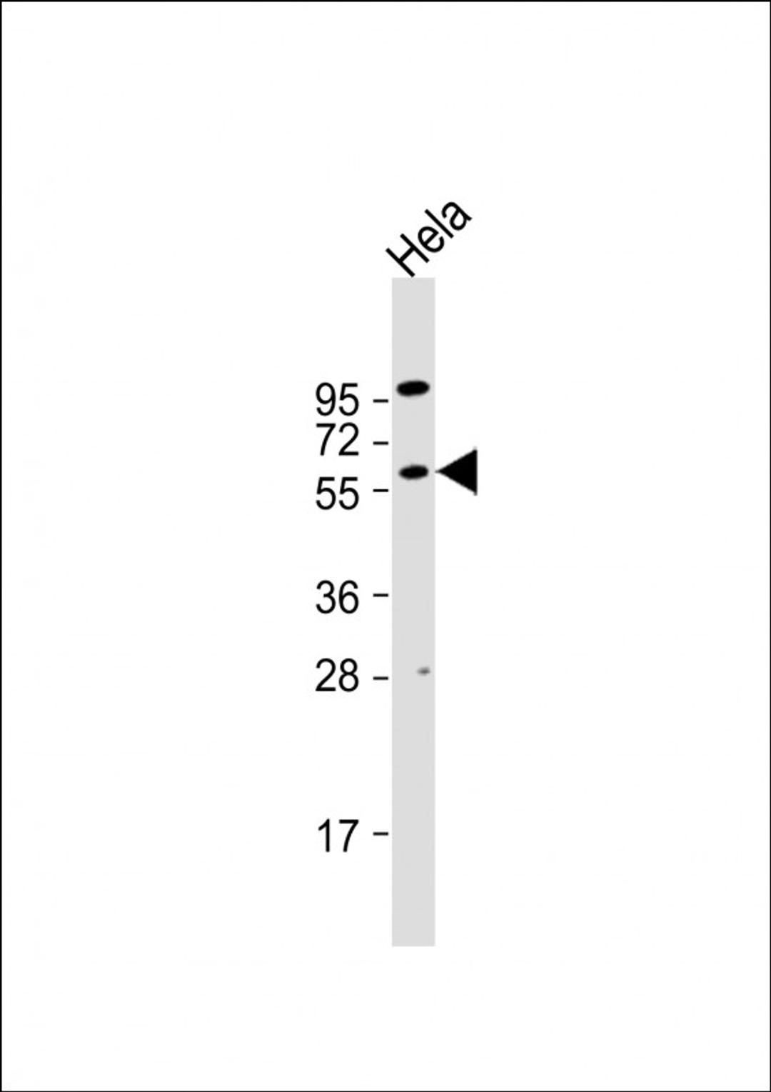 Western Blot at 1:1000 dilution + Hela whole cell lysate Lysates/proteins at 20 ug per lane.