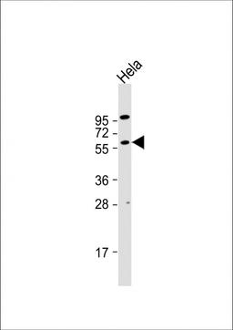 Western Blot at 1:1000 dilution + Hela whole cell lysate Lysates/proteins at 20 ug per lane.