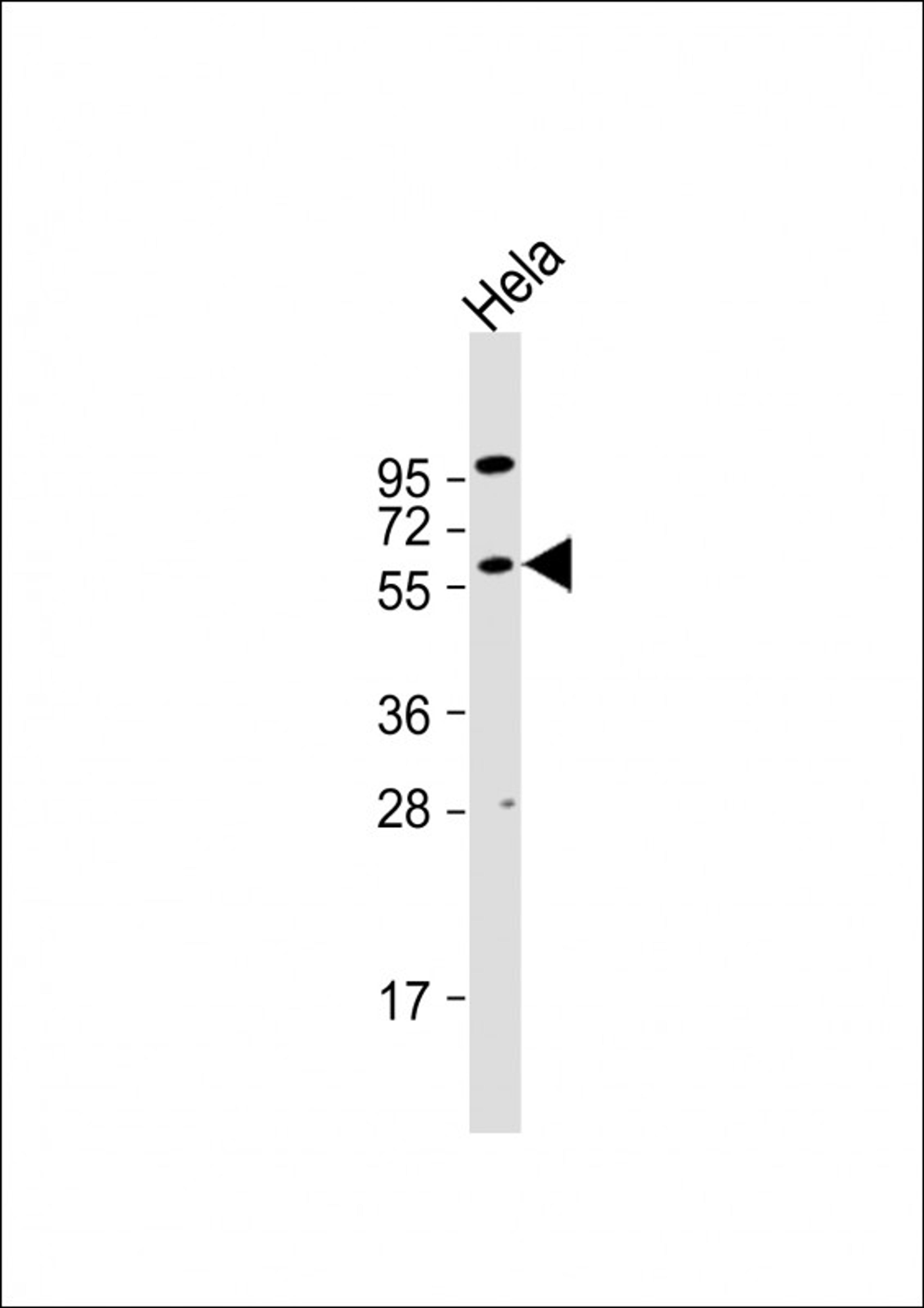 Western Blot at 1:1000 dilution + Hela whole cell lysate Lysates/proteins at 20 ug per lane.