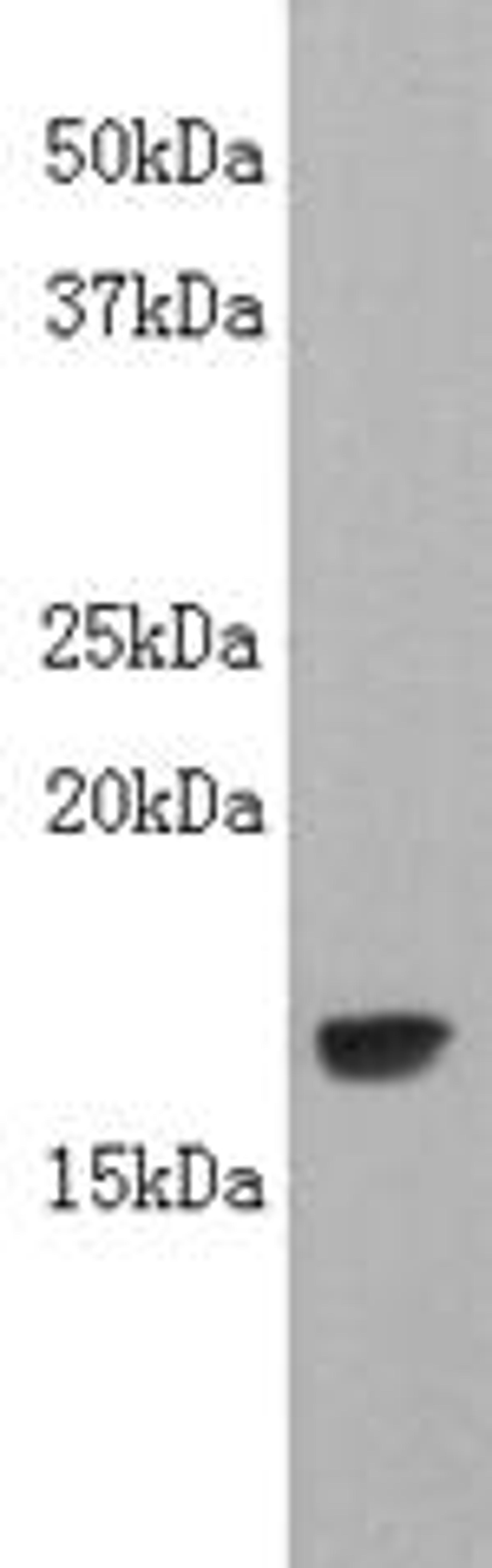 Western Blot analysis of Lymphotoxin alpha  (TNF-beta) using Lymphotoxin alpha antibody