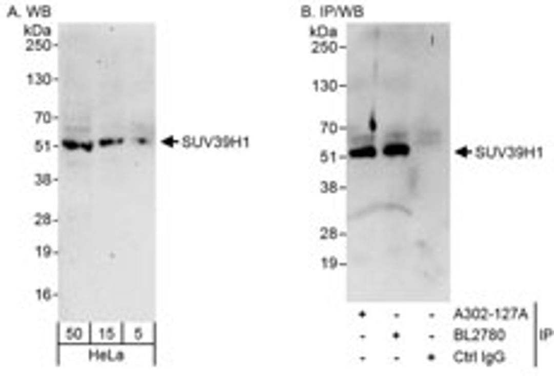 Detection of human SUV39H1 by western blot and immunoprecipitation.