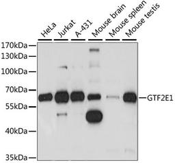 Western blot - GTF2E1 antibody (A15275)