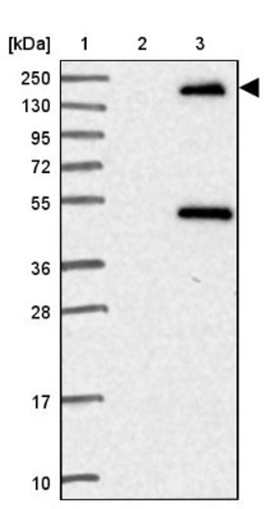 Western Blot: STAG3 Antibody [NBP2-47258] - Lane 1: Marker [kDa] 250, 130, 95, 72, 55, 36, 28, 17, 10.  Lane 2: Human cell line RT-4.  Lane 3: Human cell line U-251MG.