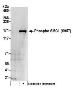 Detection of human Phospho SMC1 (S957) by western blot.