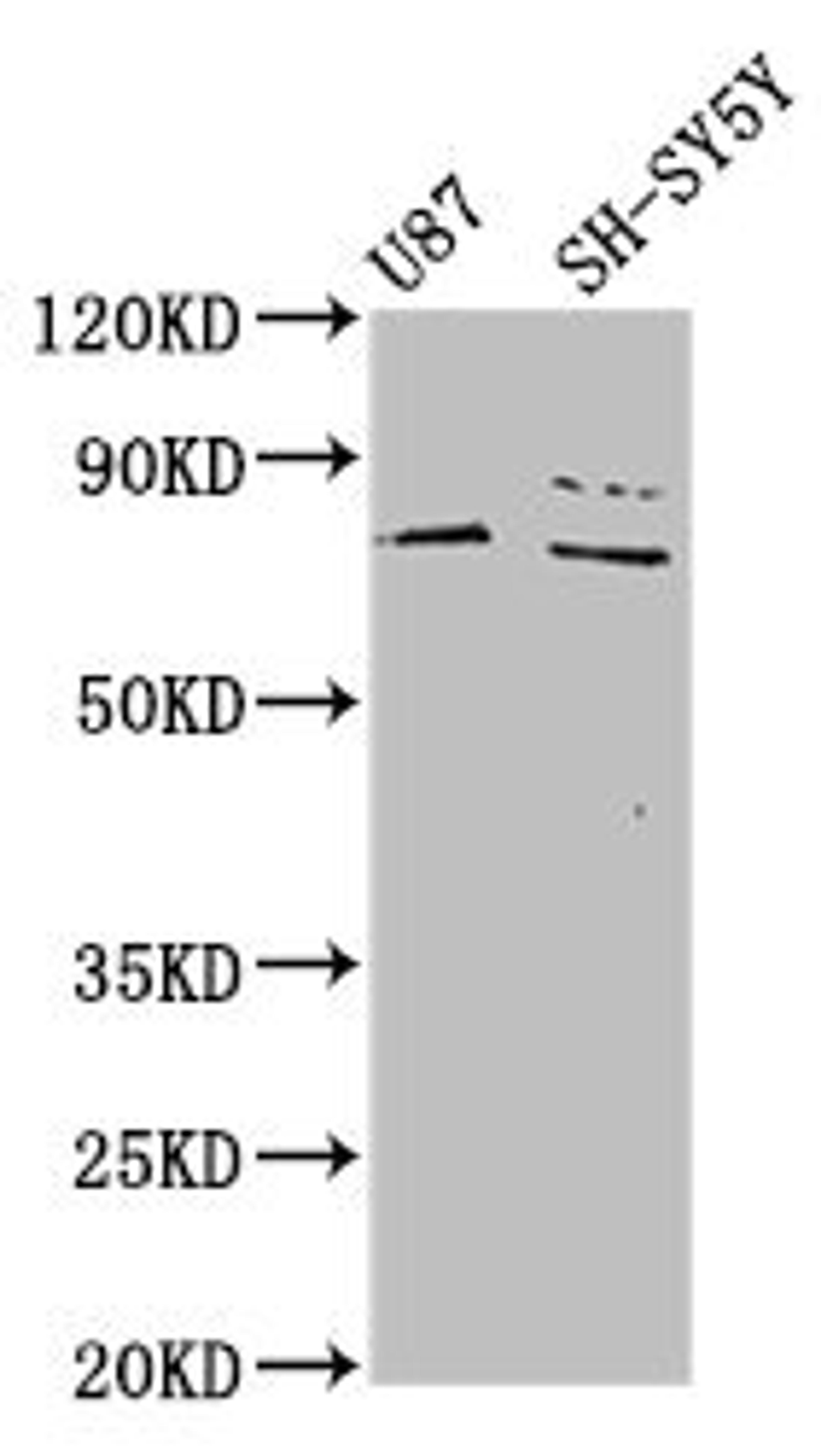Western Blot. Positive WB detected in: U87 whole cell lysate, SH-SY5Y whole cell lysate. All lanes: TIPARP antibody at 4.6µg/ml. Secondary. Goat polyclonal to rabbit IgG at 1/50000 dilution. Predicted band size: 77 kDa. Observed band size: 77 kDa
