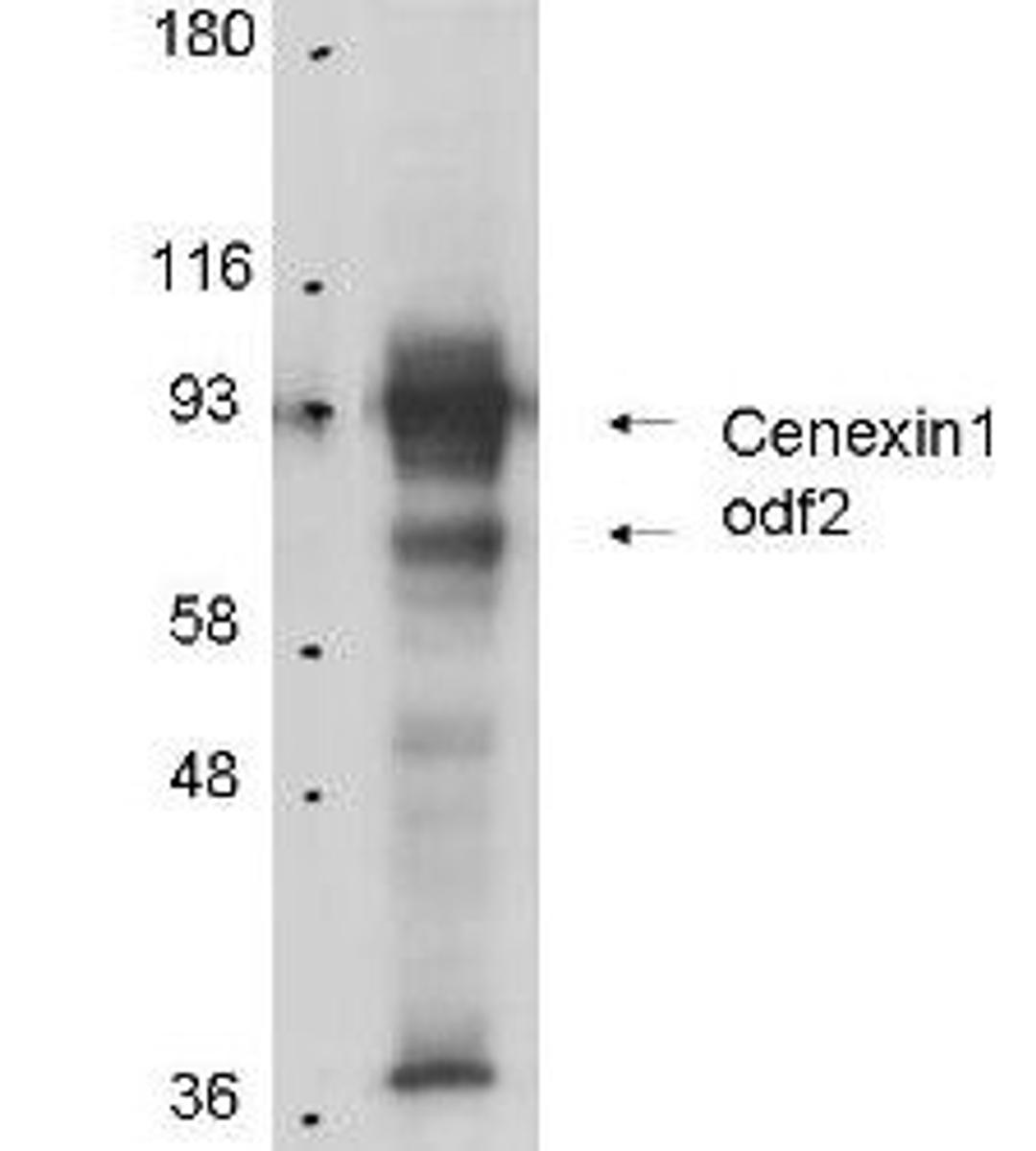 Western blot analysis of total cell lysates from mouse F9 embryonic carcinoma cells using Cenexin-1 antibody