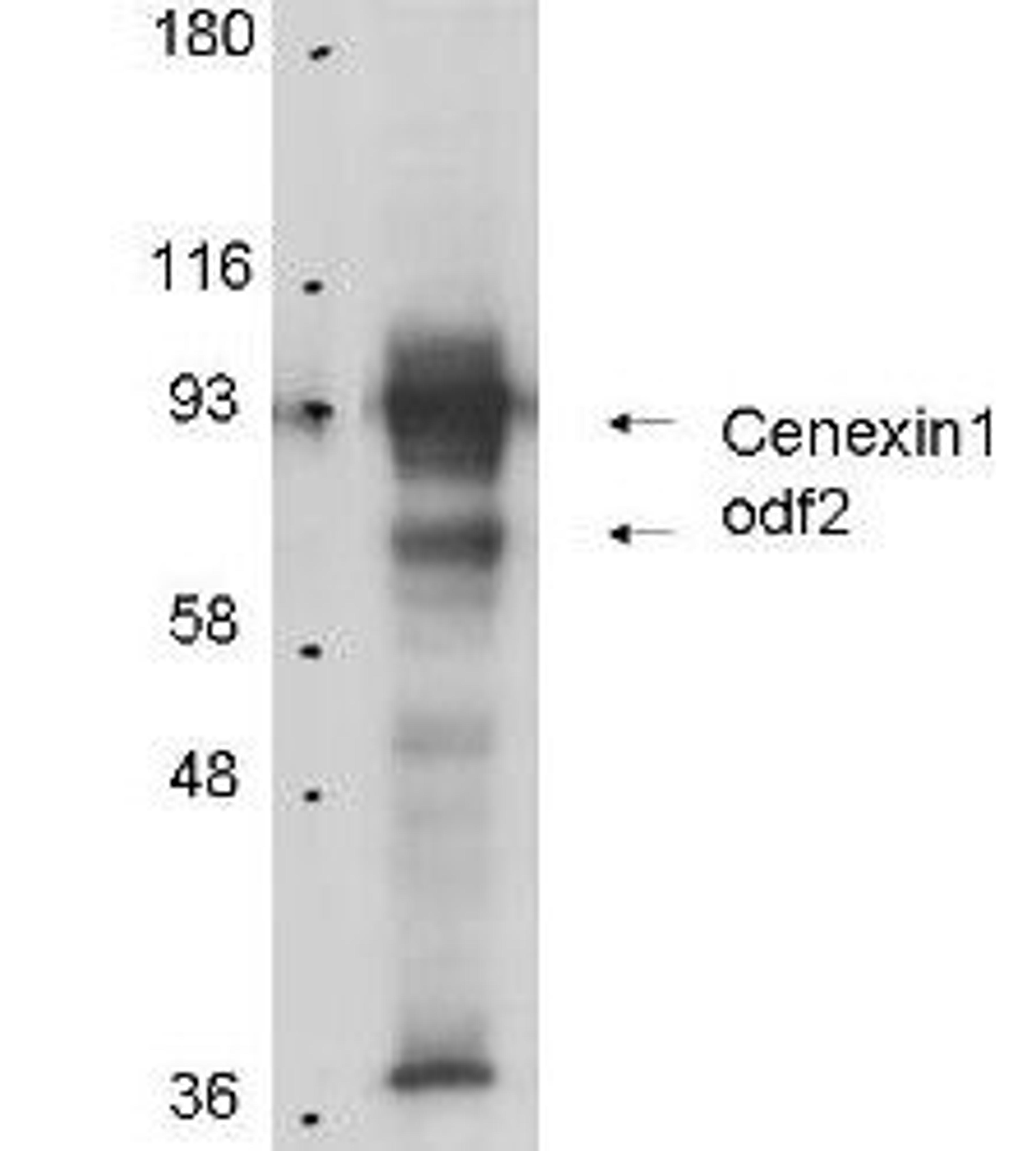 Western blot analysis of total cell lysates from mouse F9 embryonic carcinoma cells using Cenexin-1 antibody