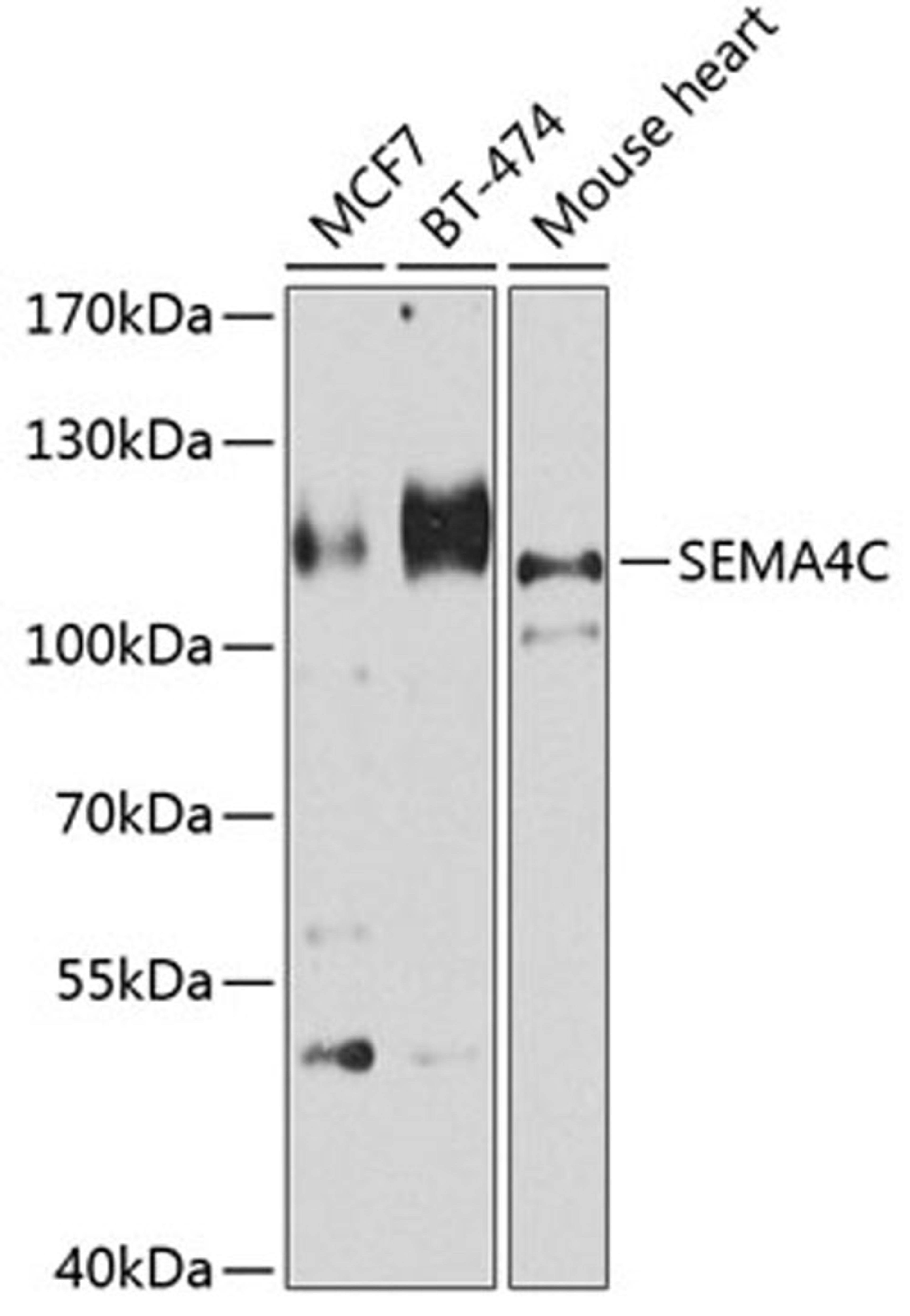 Western blot - SEMA4C antibody (A8225)