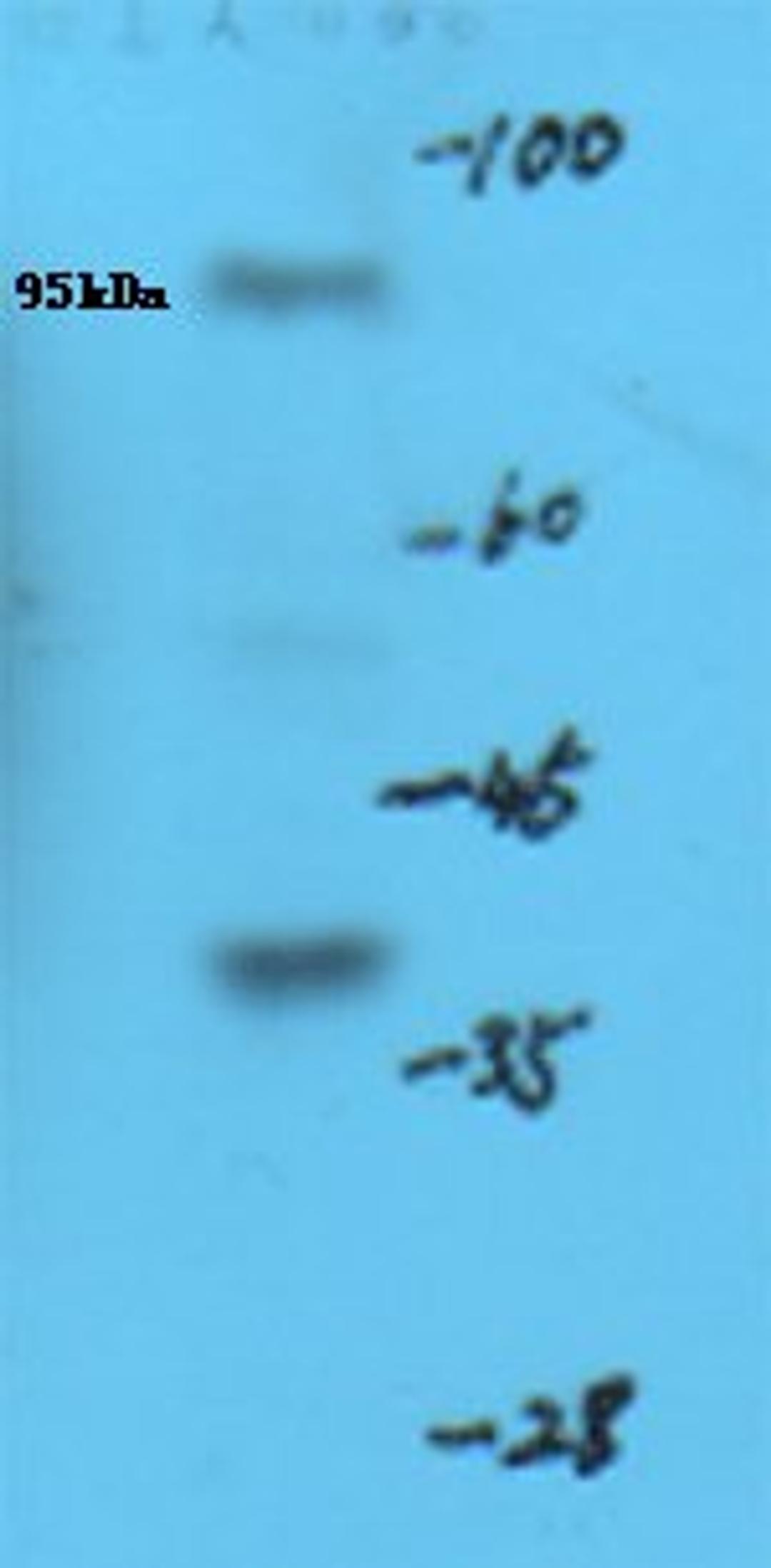 Western blot analysis of mouse brain tissue using HMGCR (phospho-Ser872) antibody.