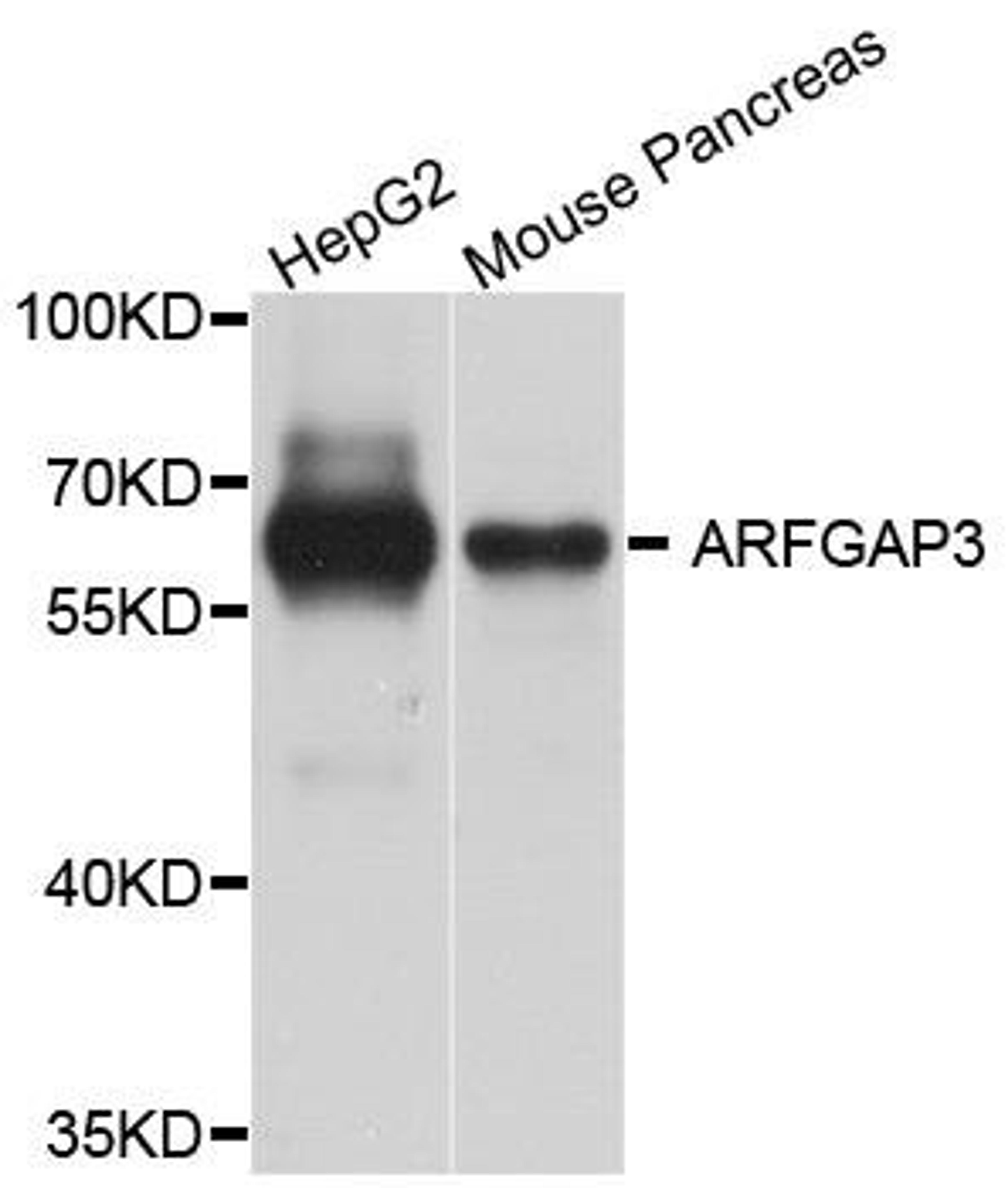 Western blot analysis of extract of various cells using ARFGAP3 antibody