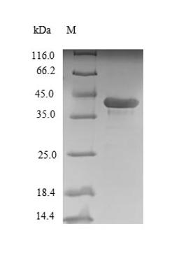 (Tris-Glycine gel) Discontinuous SDS-PAGE (reduced) with 5% enrichment gel and 15% separation gel.