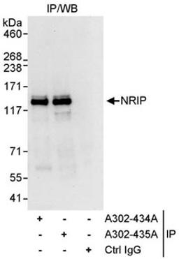 Detection of human NRIP by western blot of immunoprecipitates.