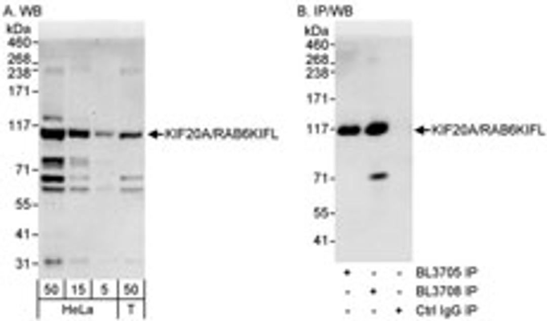 Detection of human KIF20A/RAB6KIFL by western blot and immunoprecipitation.