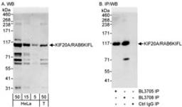 Detection of human KIF20A/RAB6KIFL by western blot and immunoprecipitation.