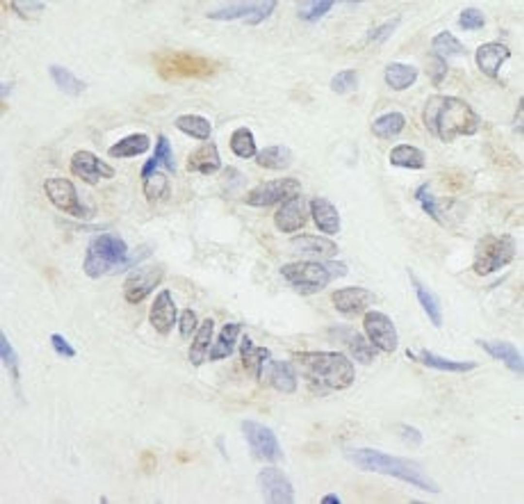 Detection of human RNF20 by immunohistochemistry.