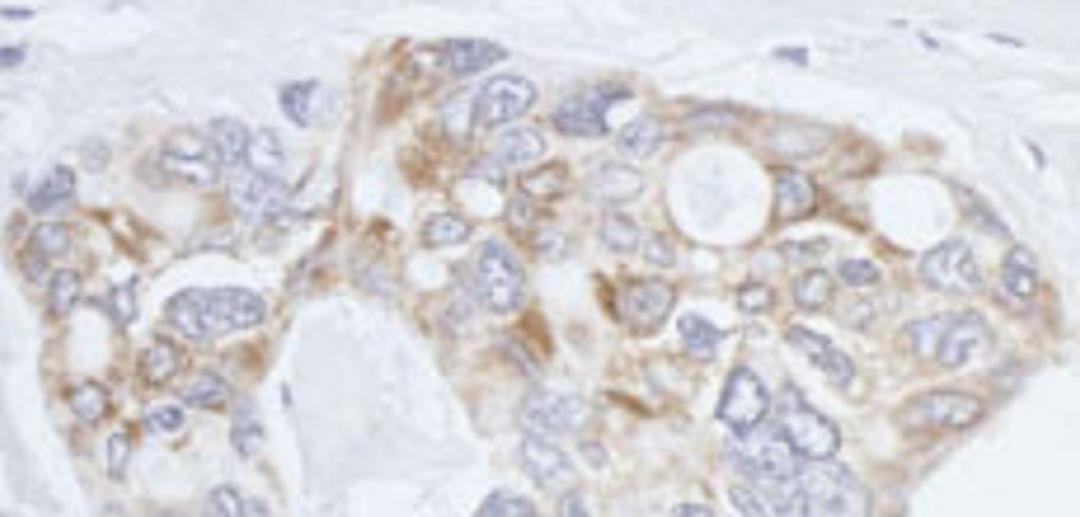 Detection of human eIF3X by immunohistochemistry.