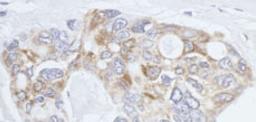 Detection of human eIF3X by immunohistochemistry.